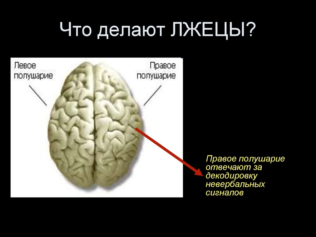 Болят полушария мозга. Болит левое полушарие. Болит левое полушарие мозга. Что если болит левое полушарие головы. Ноет левое полушарие головы.