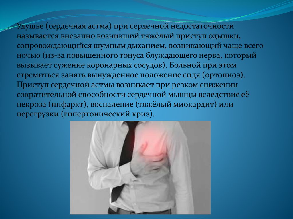 Как называется внезапно. Сердечная астма презентация. Доврачебная помощь при сердечной астме. Заболевания сопровождающиеся удушьем. Сердечная недостаточность удушье.