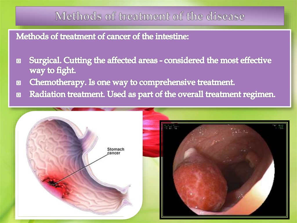 Methods of treatment of the disease