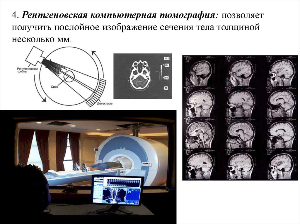 Для получения изображения в компьютерной томографии используется