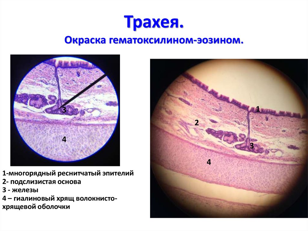 Трахея гистология препарат рисунок