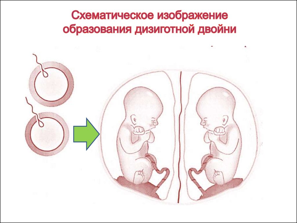 Планирование беременности презентация