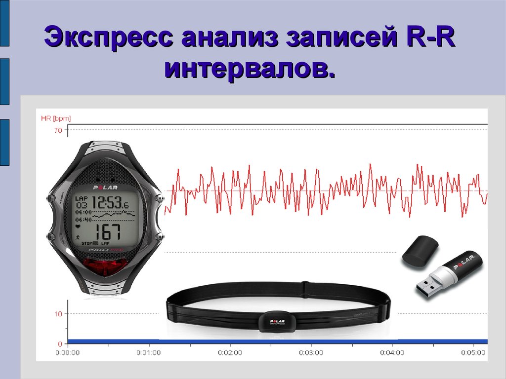 Записи р. Запись интервалов. Экспресс анализ детали. Анализ видеозаписи. Экспресс разбор.