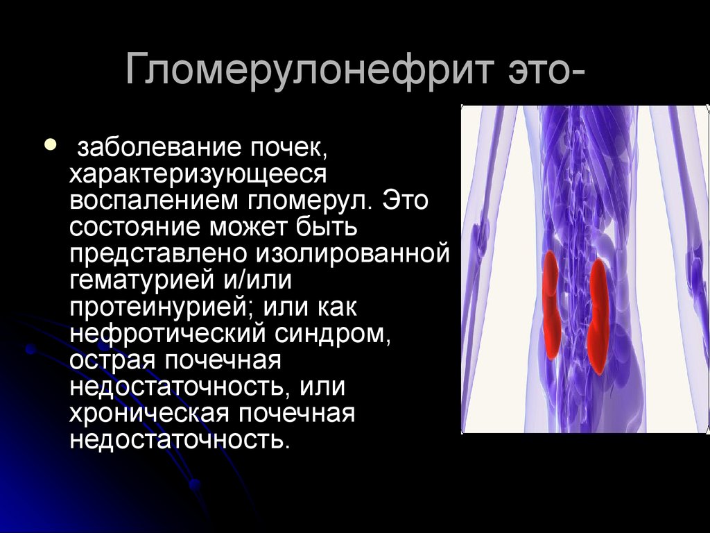 Презентация по гломерулонефриту