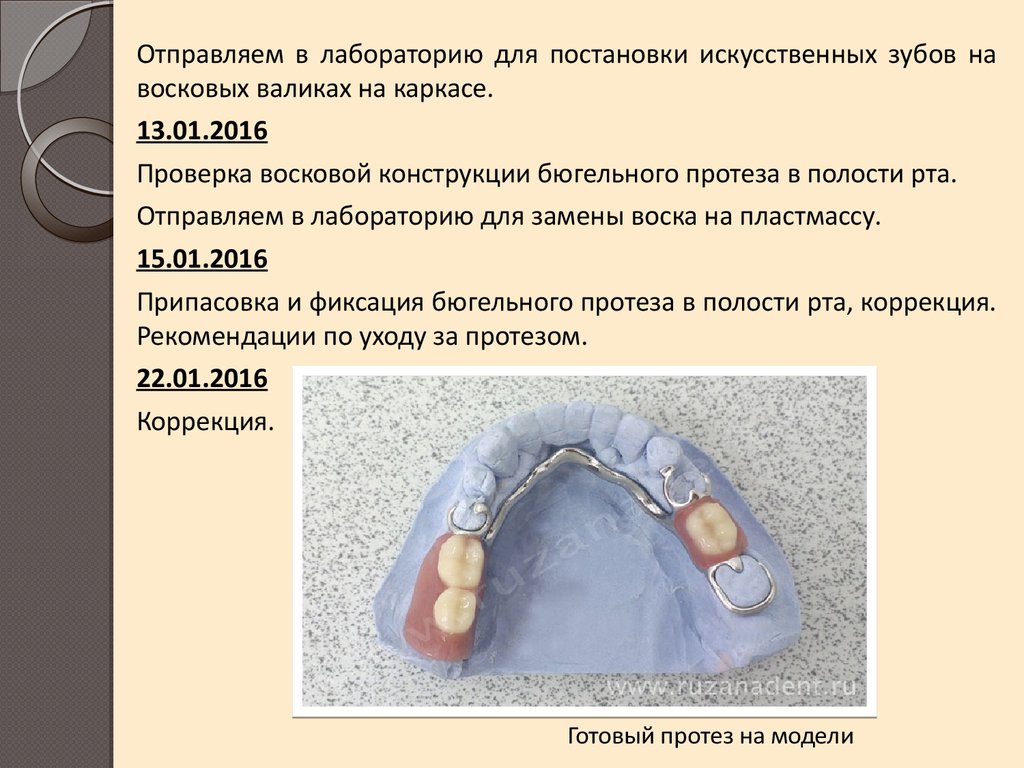 Искусственные коронки ортопедическая стоматология презентация