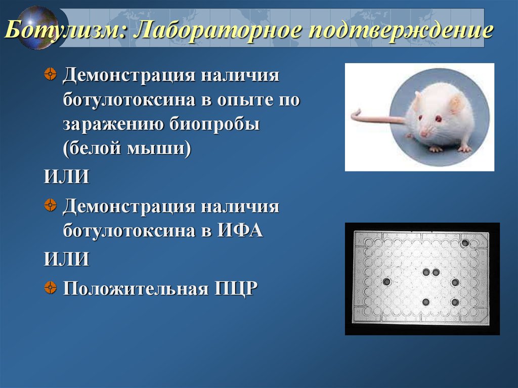 План обследования при ботулизме