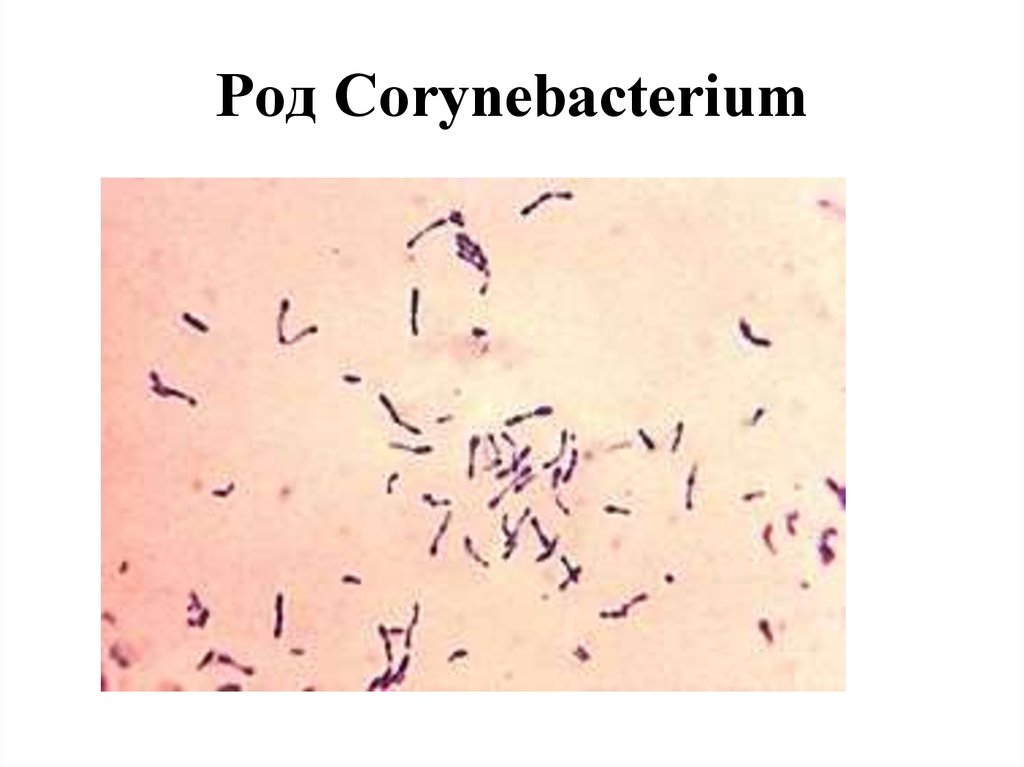 Дифтероиды в мазке на флору. Коринебактерии дифтерии микроскопия. Коринебактерии грамположительные бактерии. Corynebacterium diphtheriae бактерия.