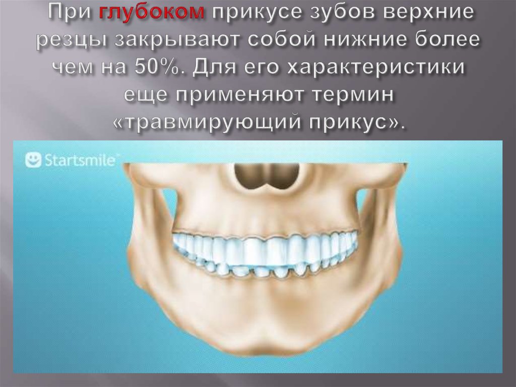 Нижний более. Глубокий прикус и нормальный. Верхняя челюсть прикрывает нижнюю. Глубокий травмирующий прикус.