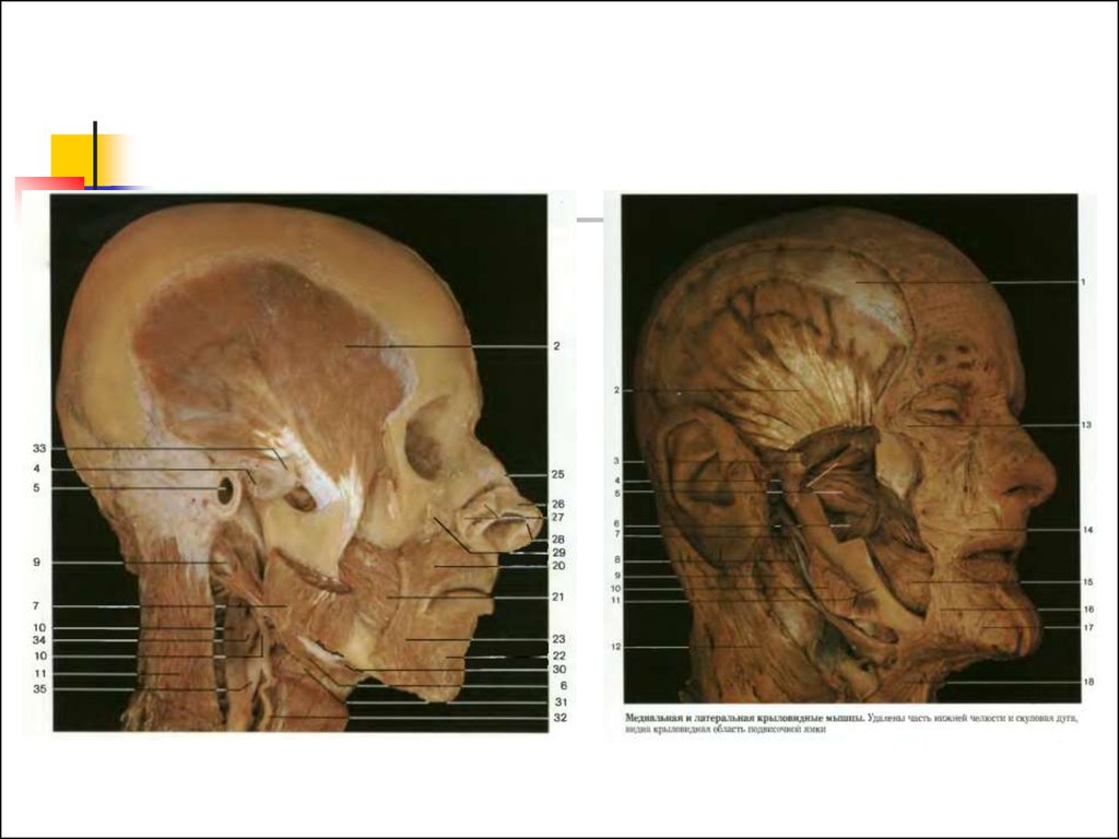 Границы лица. Латеральная область лица. Анатомия боковой области лица. Края области лица.