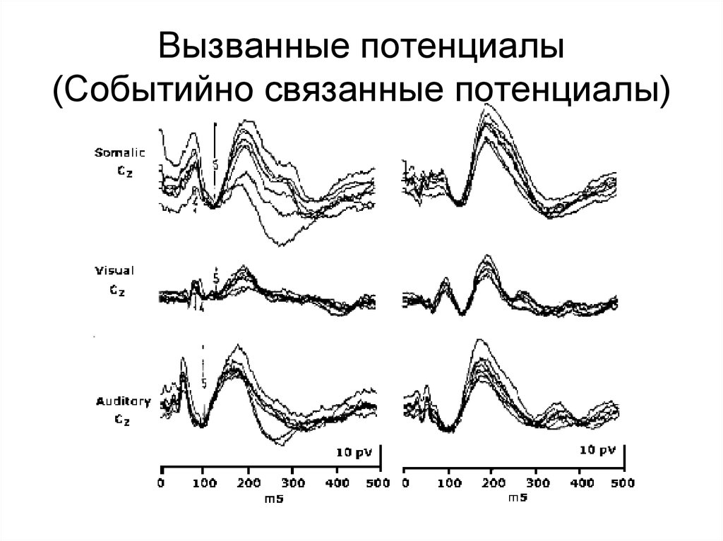 Вызванный исследования. Метод вызванных потенциалов ЭЭГ. Метод вызванных потенциалов физиология. Метод вызванных потенциалов (ВП). Метод регистрации вызванных потенциалов.