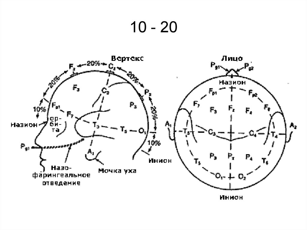 Ээг наложение электродов схема 10 20