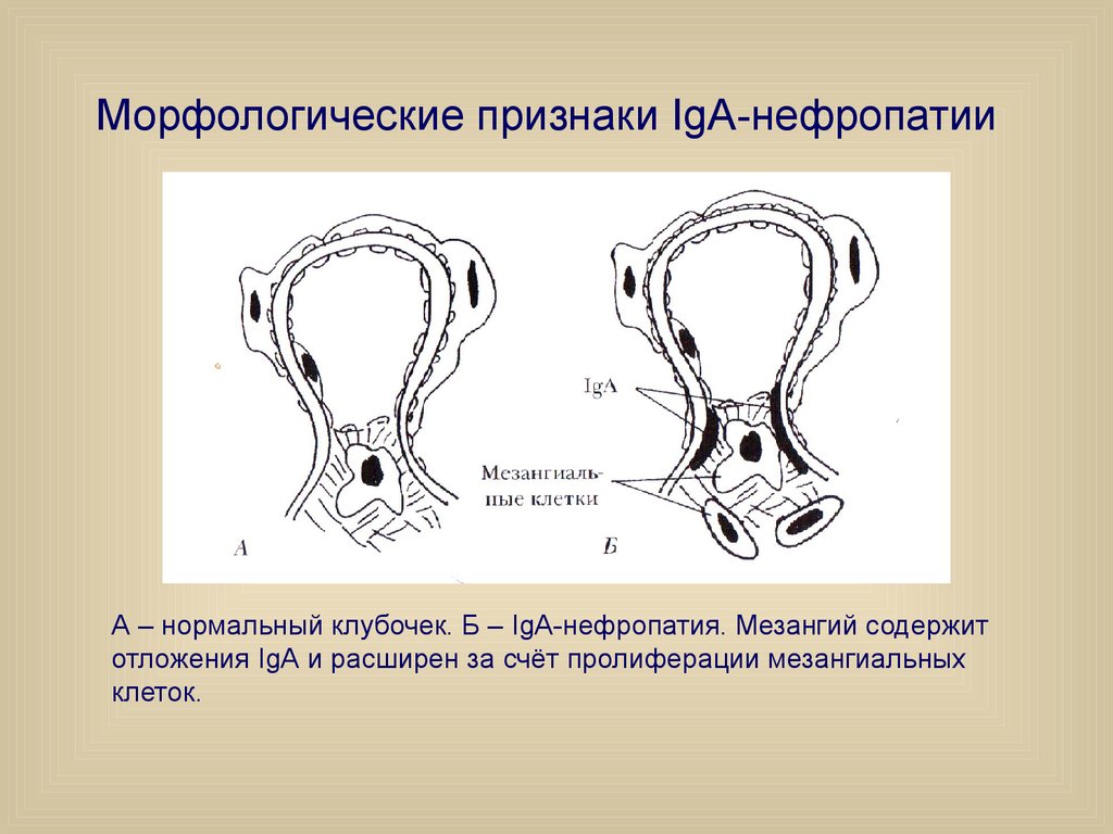 Берже болезнь презентация