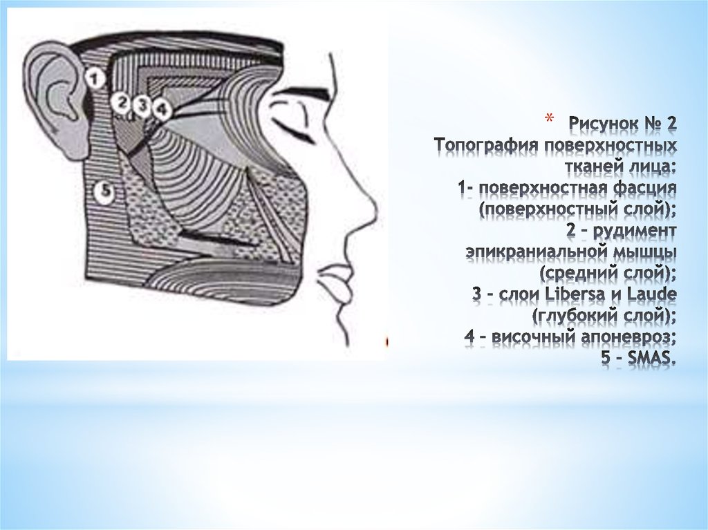Рисунок № 2 Топография поверхностных тканей лица: 1- поверхностная фасция (поверхностный слой); 2 – рудимент эпикраниальной мышцы (средний с