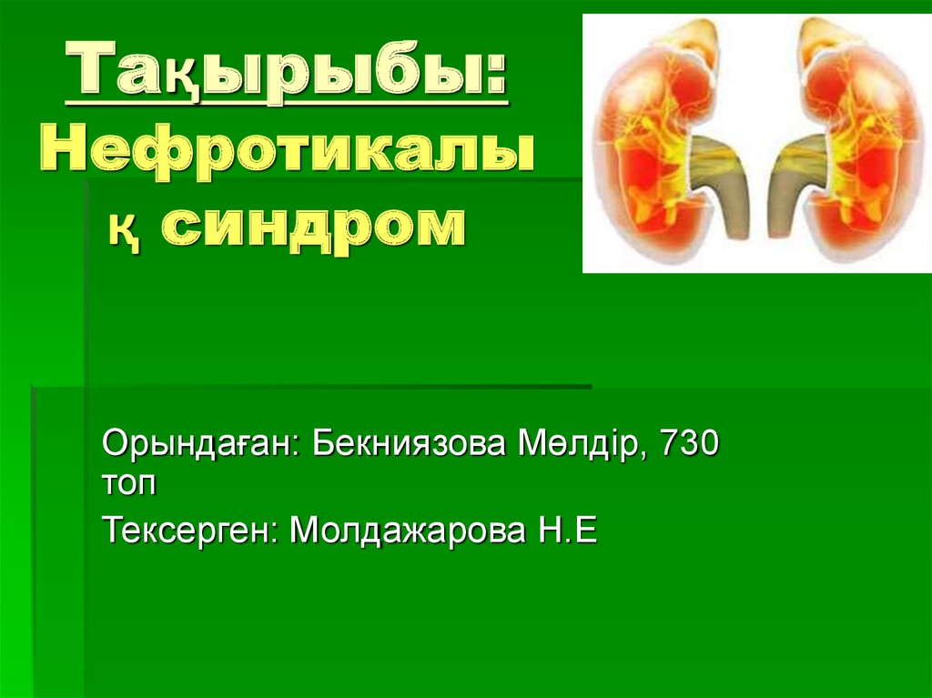 Нефротикалық синдром - презентация онлайн