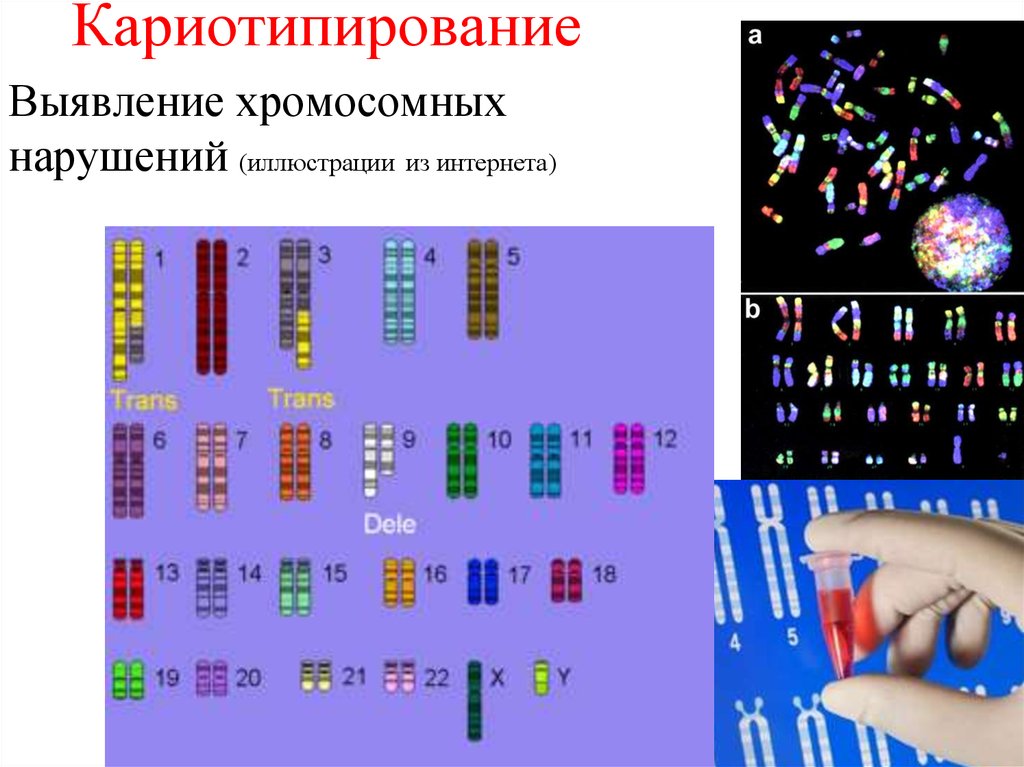 Цитогенетический метод картинки