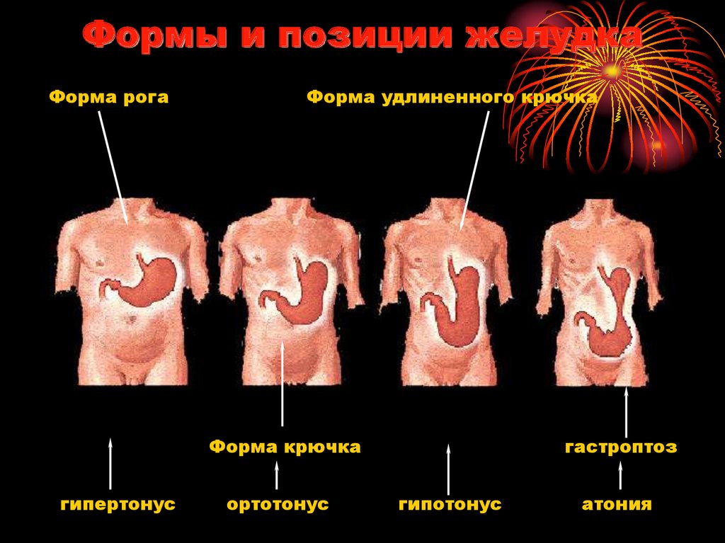 Формы желудка. Формы желудка в зависимости от телосложения. Формы и положения желудка. Форма желудка в зависимости от типа телосложения.