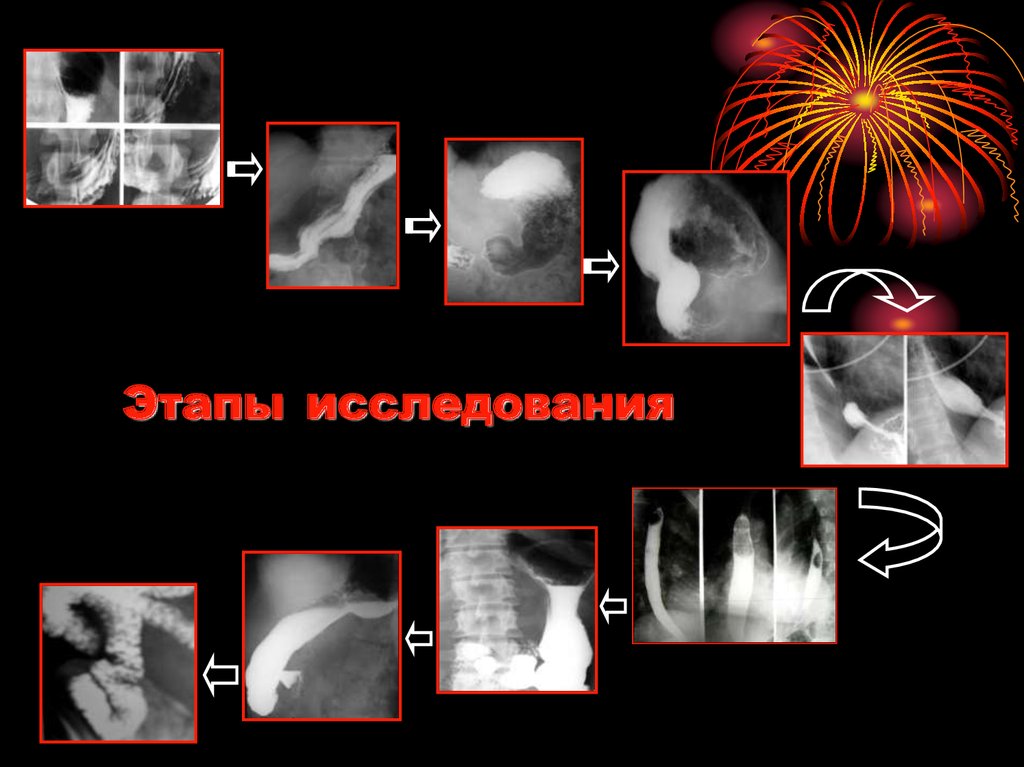 Этапы исследования
