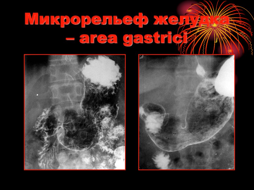 Микрорельеф желудка – area gastrici