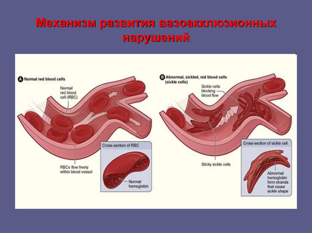 Как колоть в12 внутримышечно при анемии схема