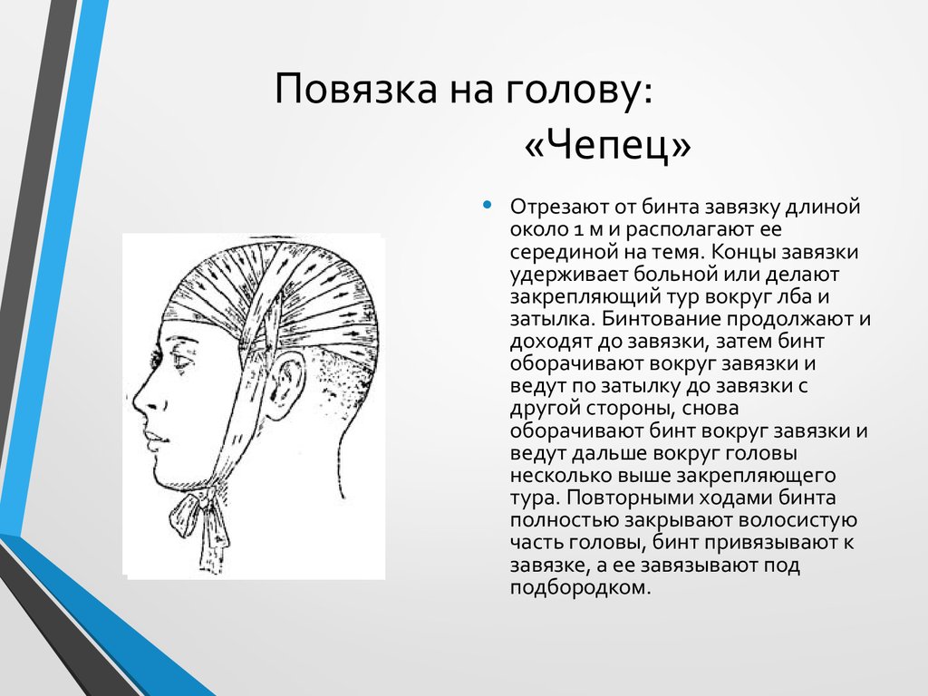 Краткое содержание голова. Десмургия повязка чепец. Чепец перевязка схема. Чепец бинтование. Наложение повязки на голову в виде Чепца.