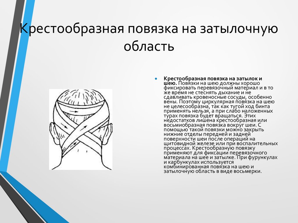 Повязка это. Наложение крестообразной повязки на затылок алгоритм. Крестообразная на затылок повязка характеристика. Крестообразная повязка на затылок и шею алгоритм. Восьмиобразная повязка на затылок и шею.