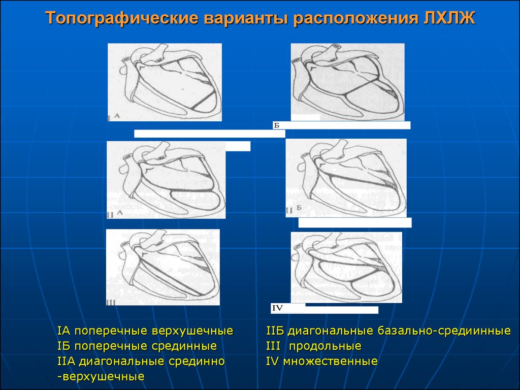 Малые аномалии развития сердца у детей презентация