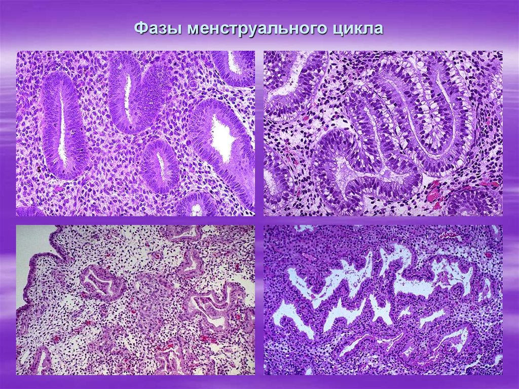 Патология последа презентация