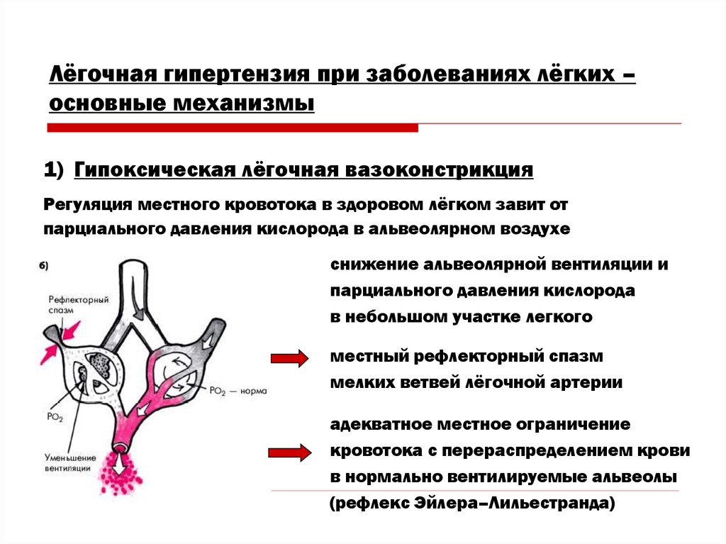 Легочная гипертензия это. Рефлекс Эйлера Лильестранда при легочной гипертензии. Альвеолярно-капиллярный рефлекс. Альвеолярная легочная гипертензия. Механизм патогенеза легочная гипертензия.