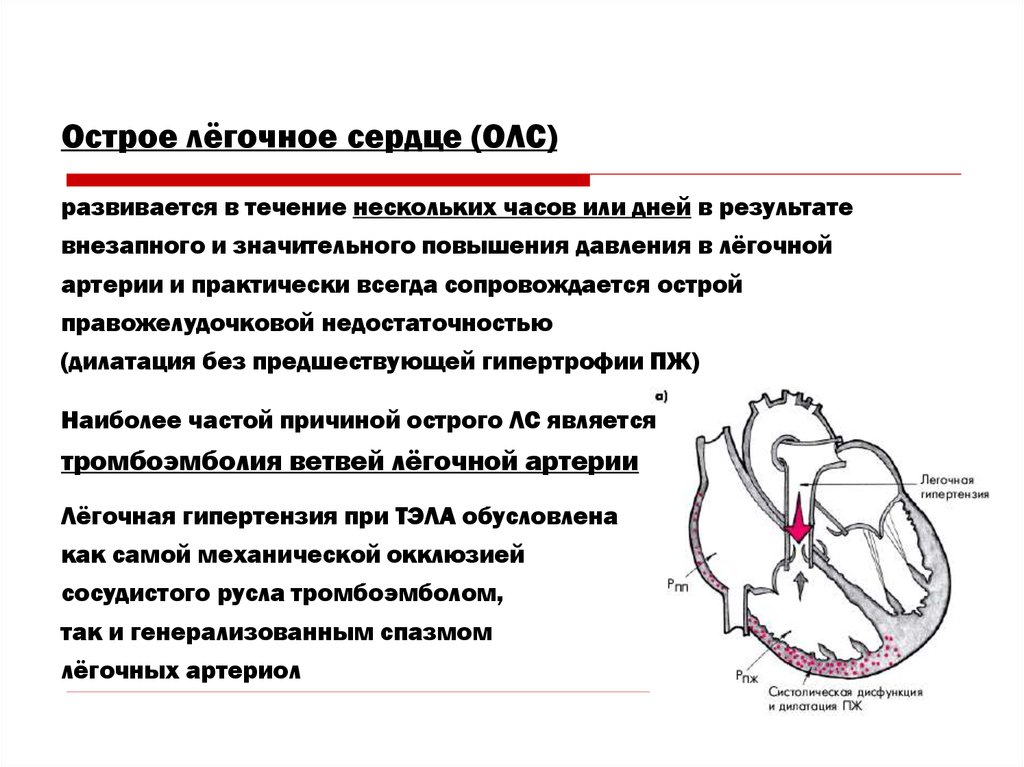 Для легочной артерии характерно. Острое легочное сердце клинические. Острое легочное сердце Струтынский. Повышение давления в легочной артерии. Острое легочное сердце развивается при.