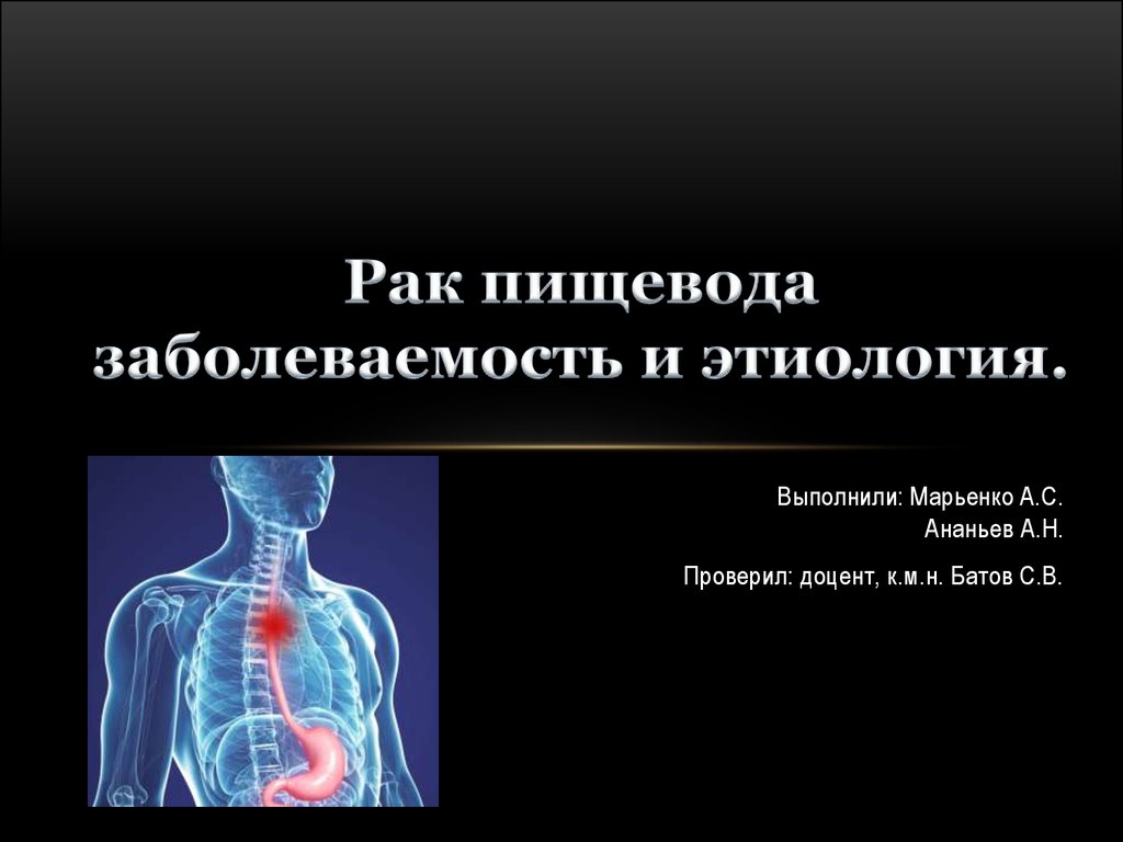 Презентация пищевода. Опухоли пищевода презентация хирургия. Онкология презентация. Презентация на тему онкология. Фото заболеваемости пищевода.