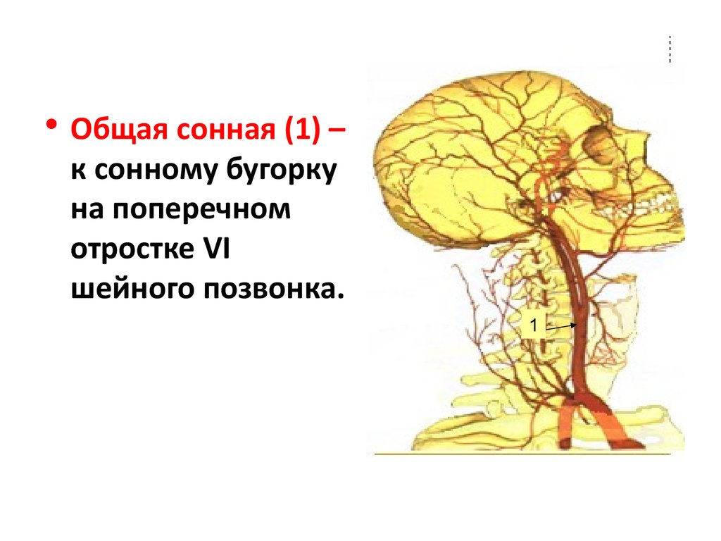 Общая сонная. Передний Сонный бугорок. Сонный бугорок поперечного отростка 6 шейного позвонка. Артериальный отросток.