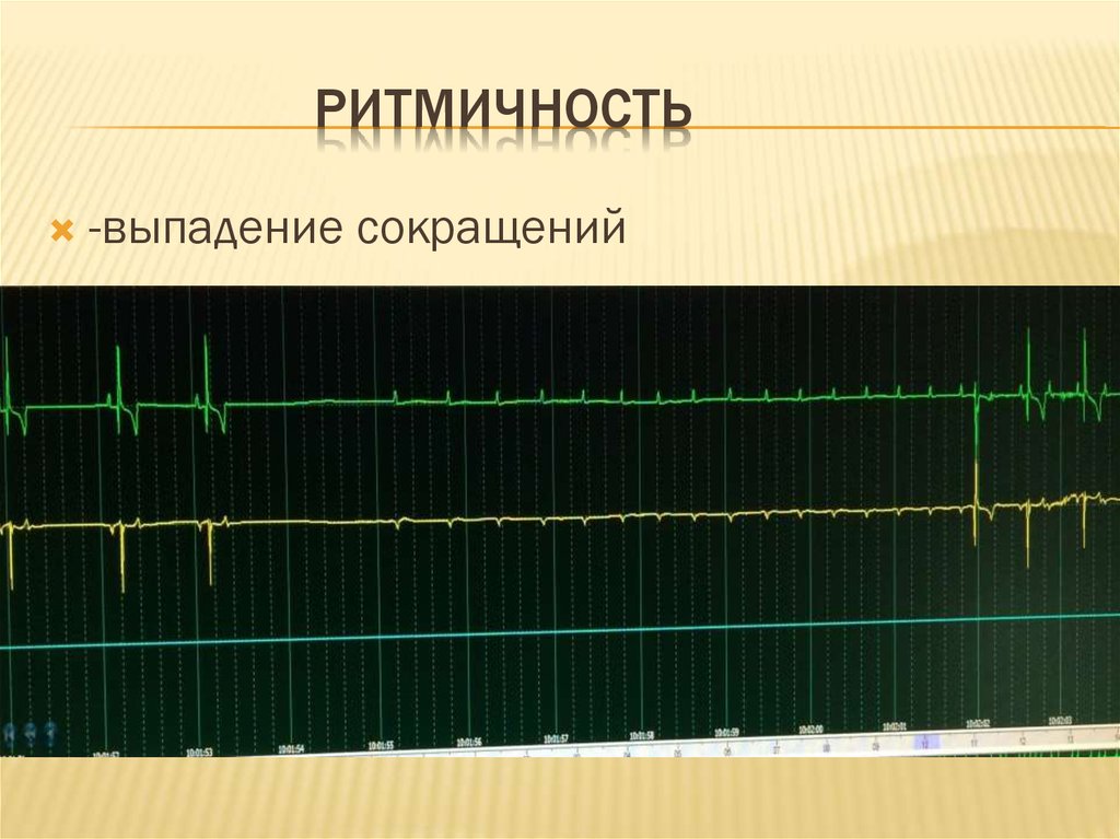 Ритмичность в биологии картинки