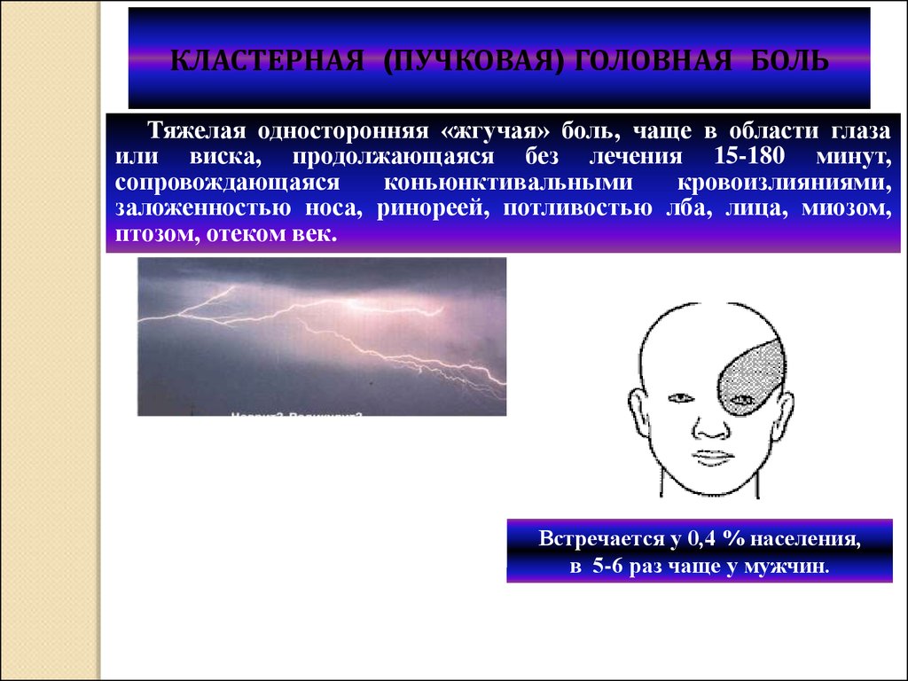 Первичная головная боль презентация