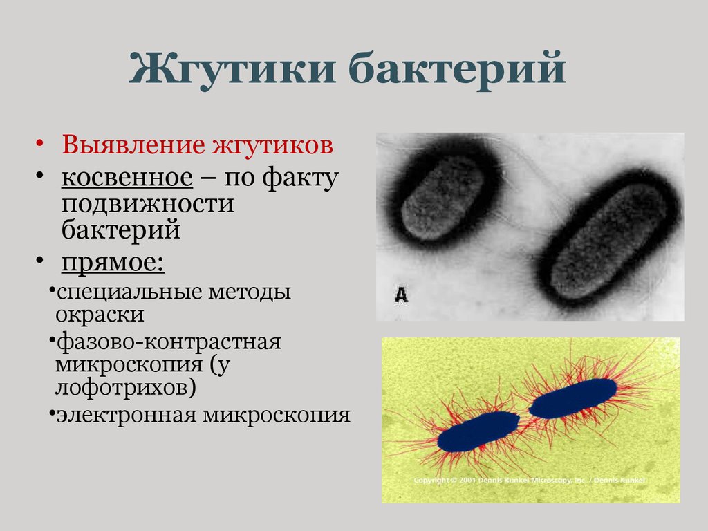40 бактерий. Метод обнаружения жгутиков у бактерий. Метод косвенного выявления жгутиков у бактерий. Прямые методы выявления жгутиков у бактерий. Структура бактериальной клетки жгутики.