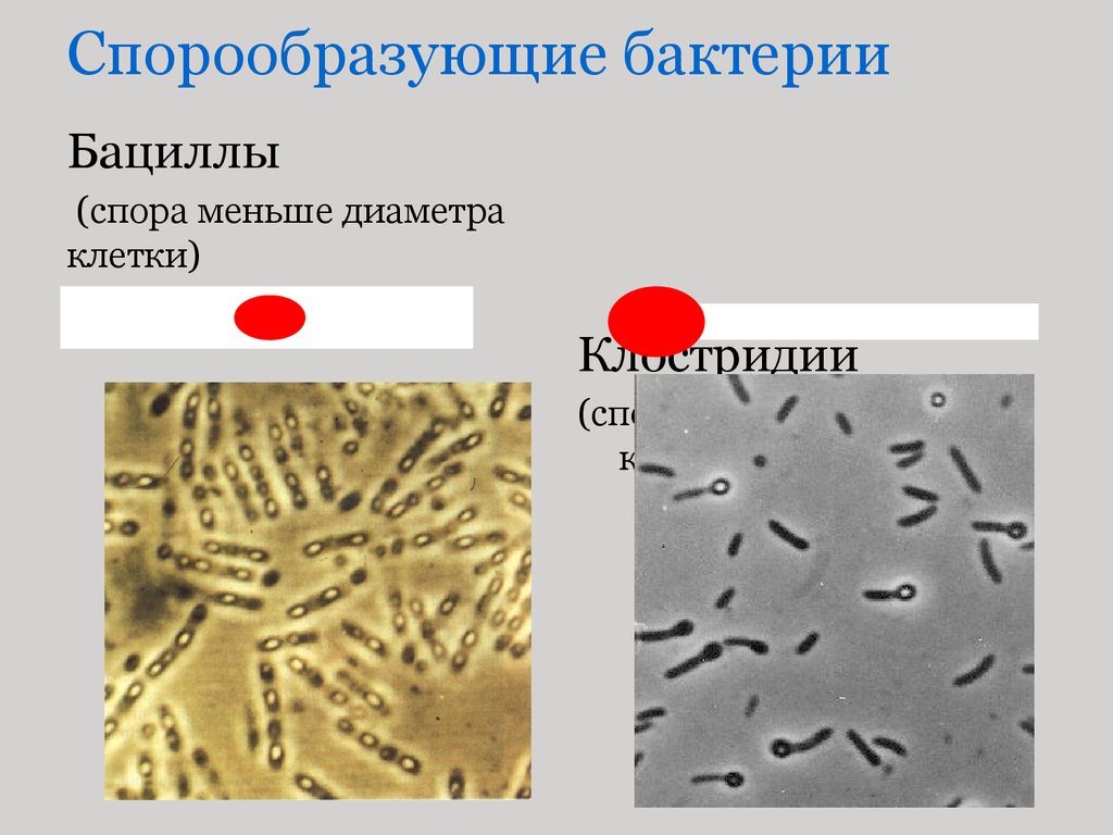 Кластридии. Палочки бактерии бациллы клостридии. Палочковидные бактерии клостридии. Спорообразующие палочковидные бактерии. Спорообразующие анаэробные бактерии называются.