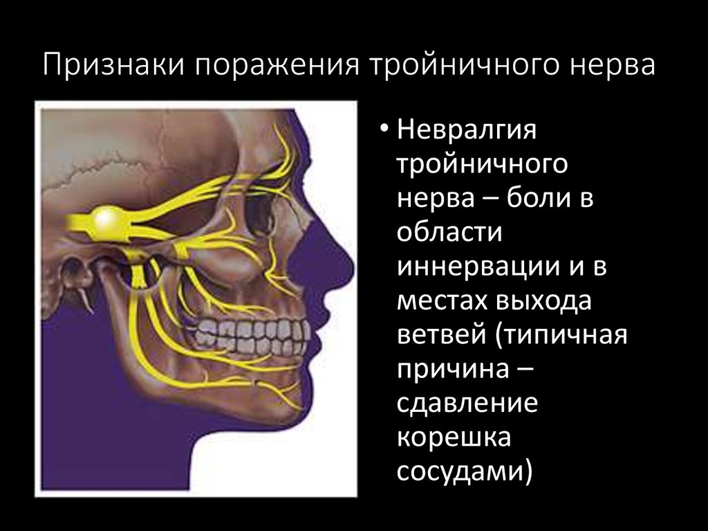 Тройничный нерв презентация