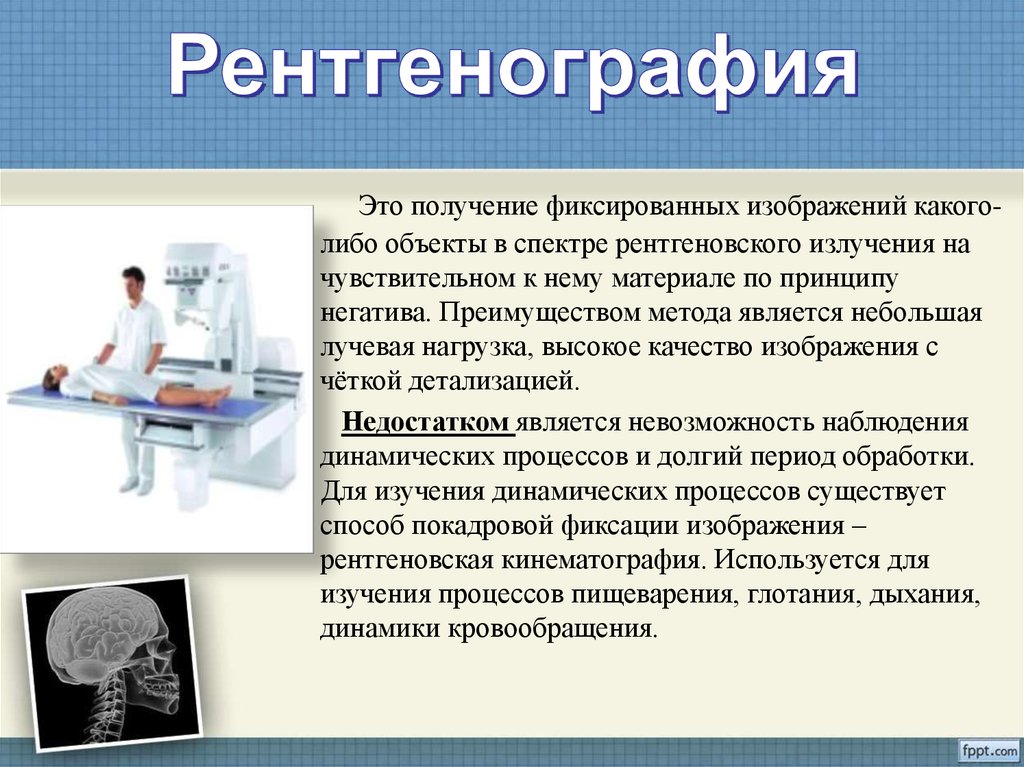 Рентгенография это. Рентгенография метод исследования. Рентгенографический метод изучения. Рентгеноскопия метод исследования. Методики рентгенографии.