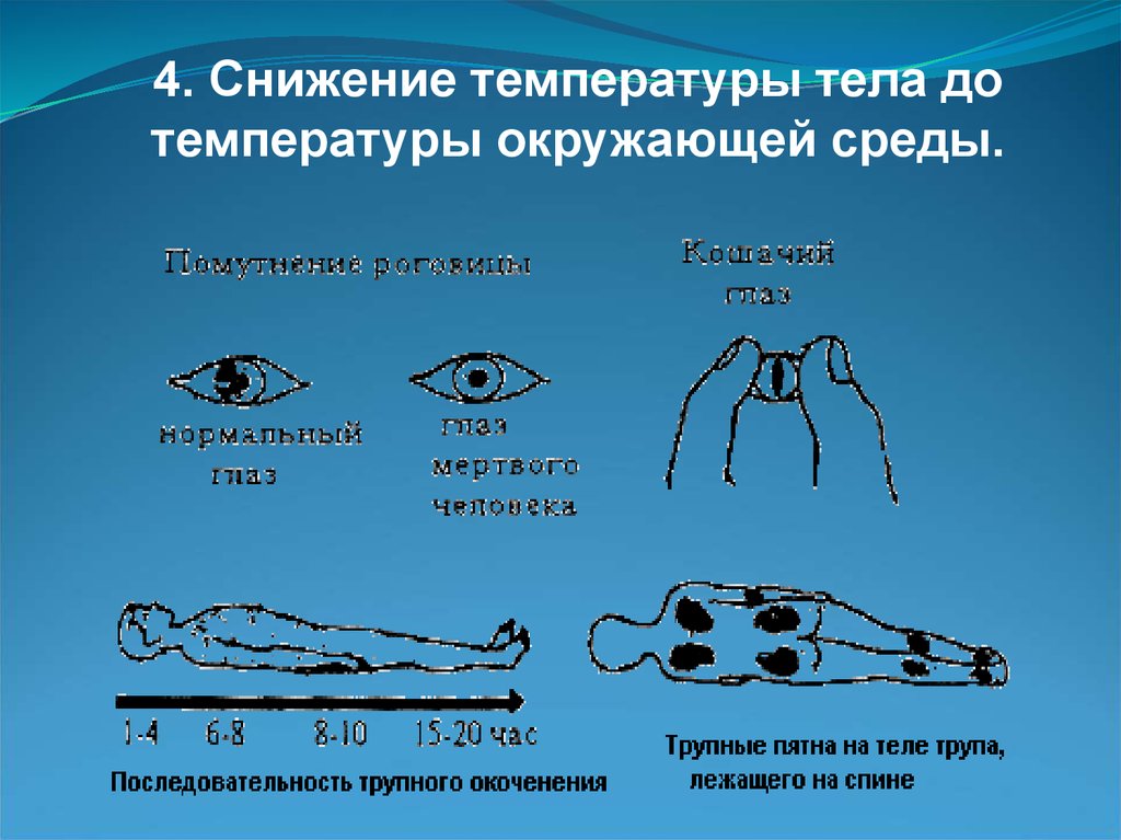 Снижение температуры. Снижение температуры тела до температуры окружающей среды. Снижение температуры у трупа. Трупное окоченение физиология. Температура тела трупа.