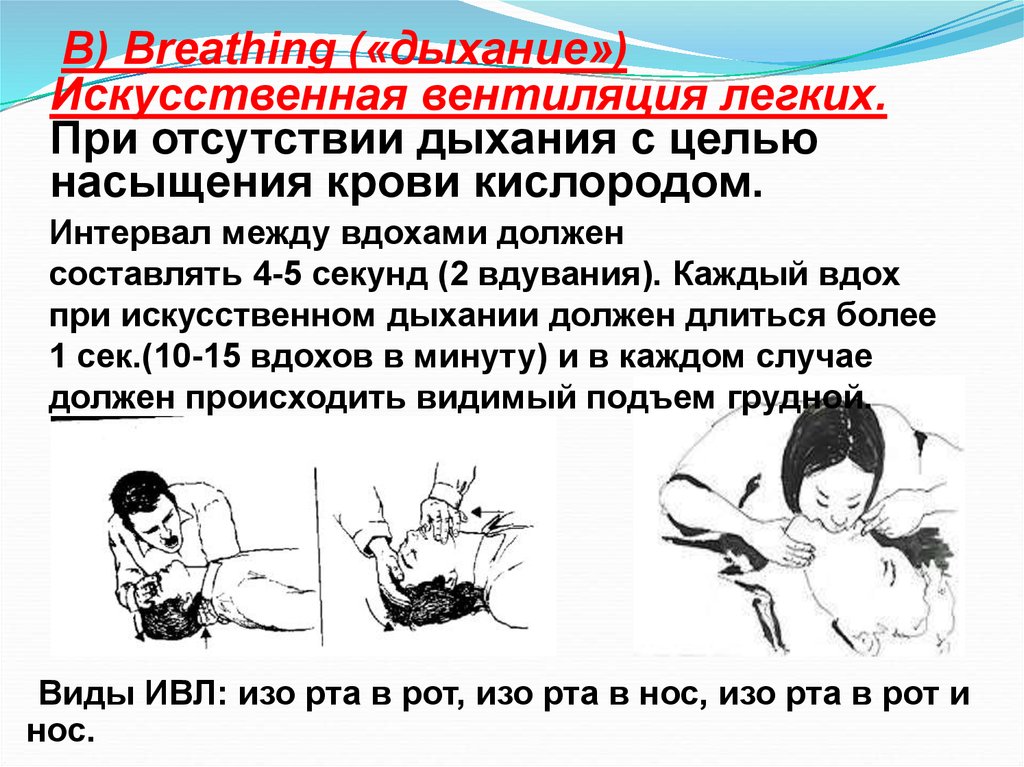 Частота искусственного дыхания в минуту