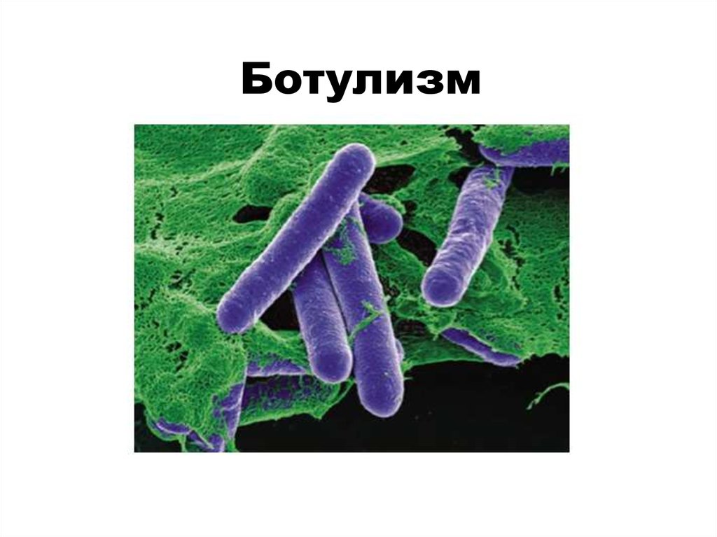 Ботулизм ауруы презентация