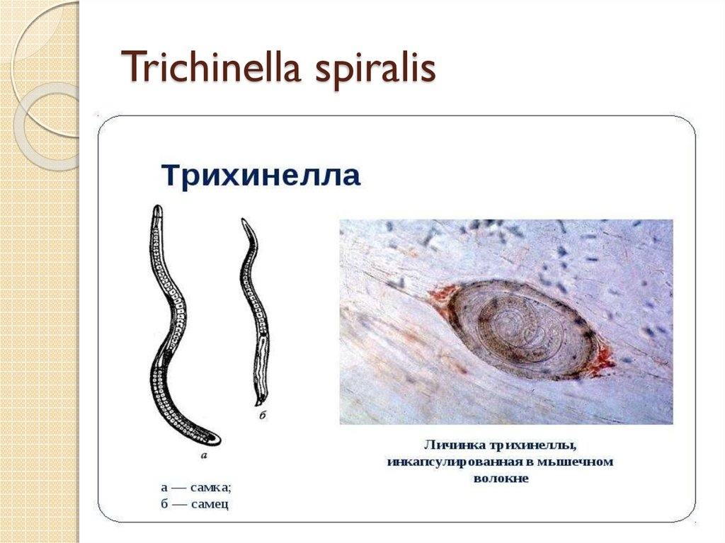 Личинка трихинеллы рисунок