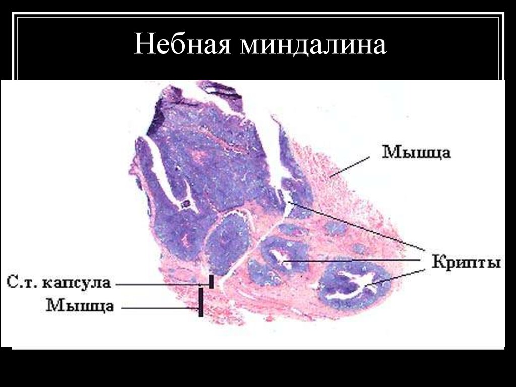 Небная миндалина гистология рисунок