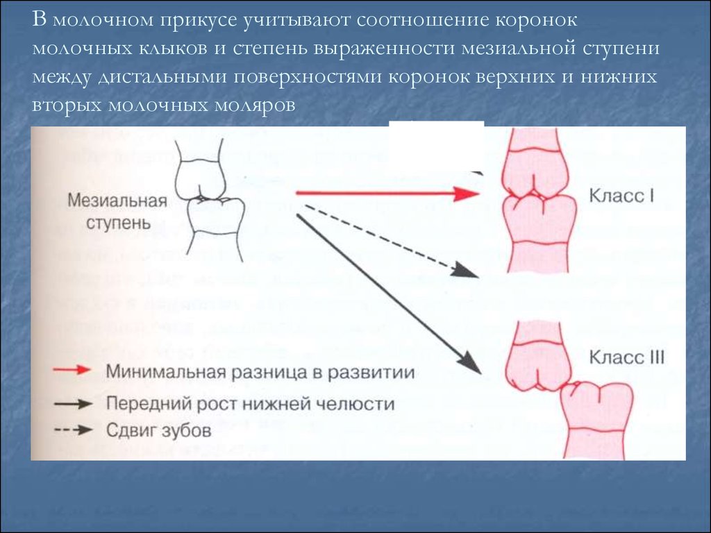 Мезиальный прикус презентация