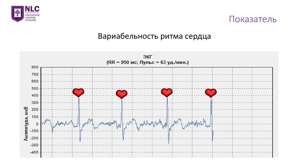 Вариабельность сердечного ритма. ВРС вариабельность ритма сердца норма. Методика анализа вариабельности сердечного ритма.. Вариабельность сердечного ритма 100мс. Вариабельность сердечного ритма ВСР.