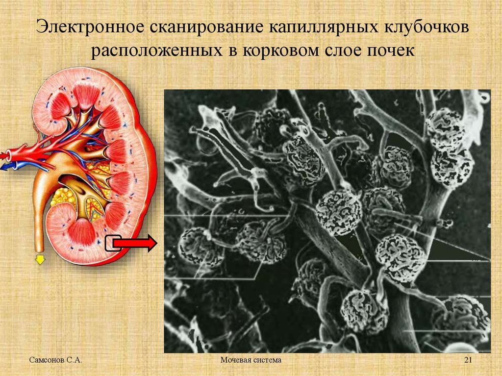 Микрофлора мочеполовой системы презентация