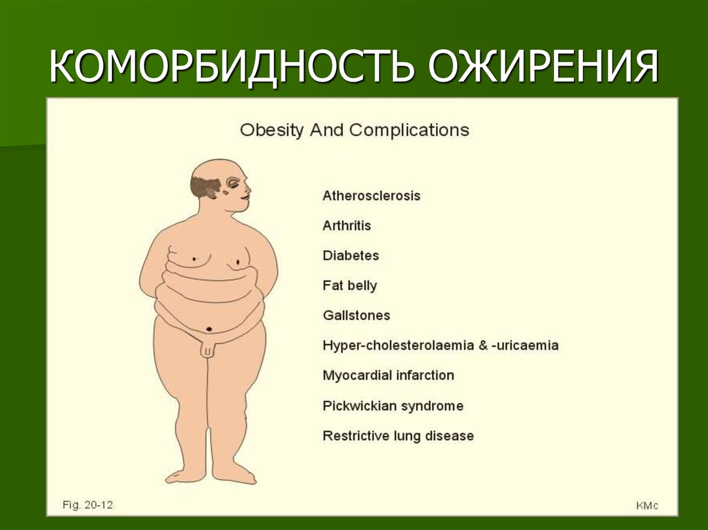 Коморбидный пациент это. Ожирение. Коморбидность. Коморбидность ожирения. Морбидное морбидное ожирение.