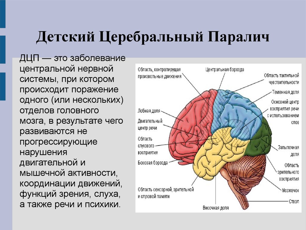 Дцп головного мозга