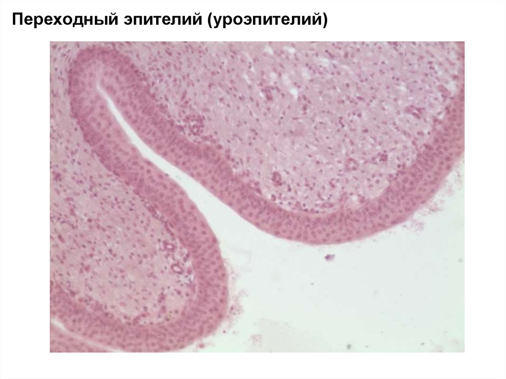 Переходный эпителий. Переходный эпителий (уроэпителий). Уротелий гистология препарат. Уроэпителий гистология препарат. Переходный эпителий уроэпителий мочевой пузырь.