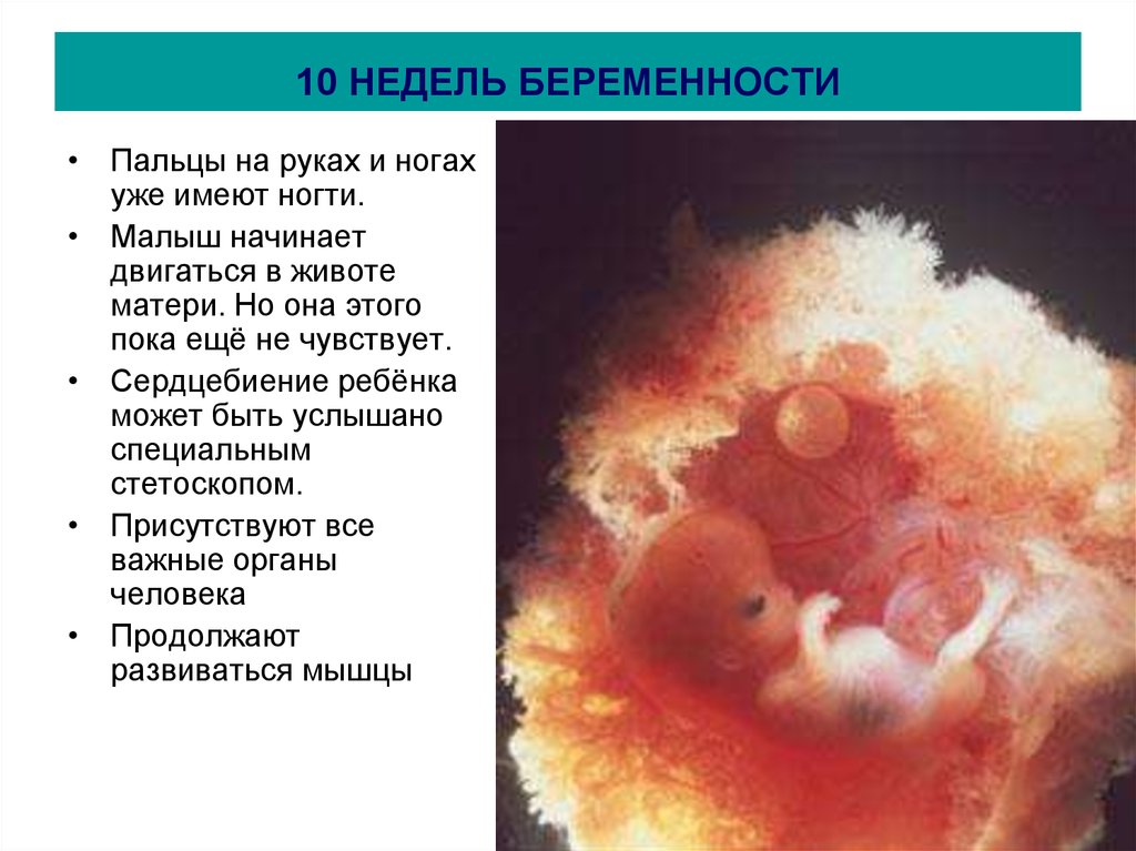 Эмбрион на какой неделе. Как выглядит эмбрион на УЗИ 9-10 недель. Ребёнок на 10 неделе беременности. Размер эмбриона в 10 недель. Как выглядит эмбрион в 10 недель на УЗИ.