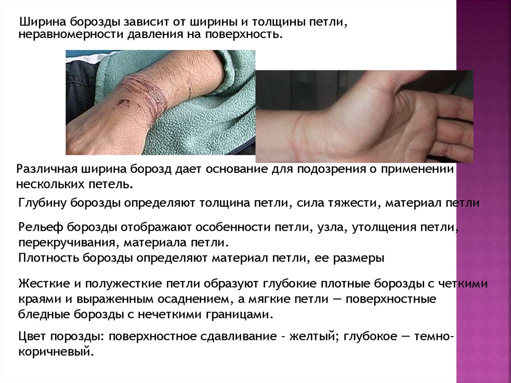 Петли и узлы в трасологии - презентация онлайн
